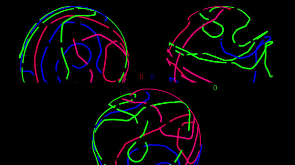 Gameplay 1